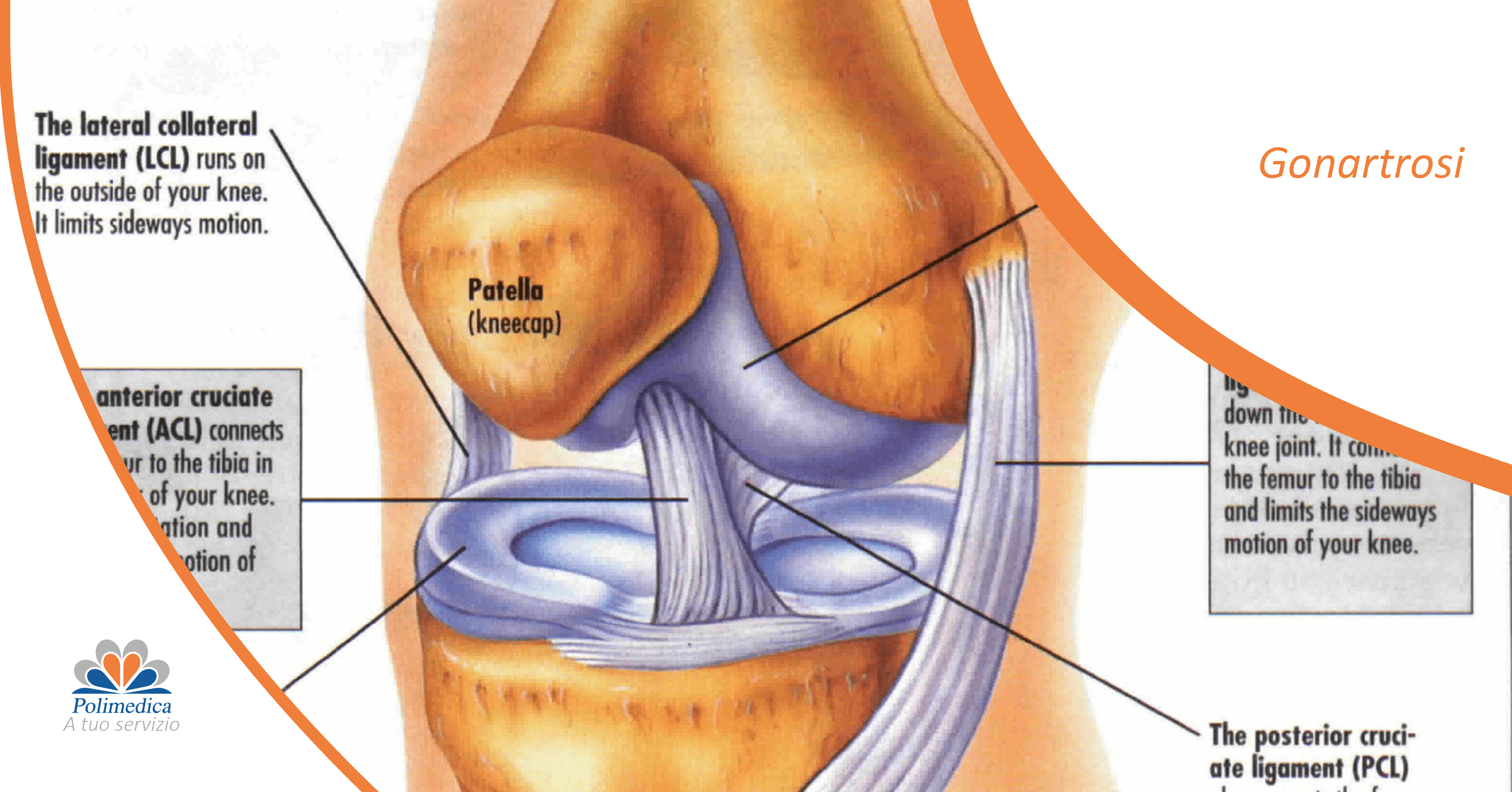 Immagine con logo di Polimedica Melfi, dell'anatomia di un ginocchio. Quando l’artrosi interessa il ginocchio, viene chiamata “gonartrosi”. Immagine di accompagnamento all'articolo dedicato alla gonartrosi.