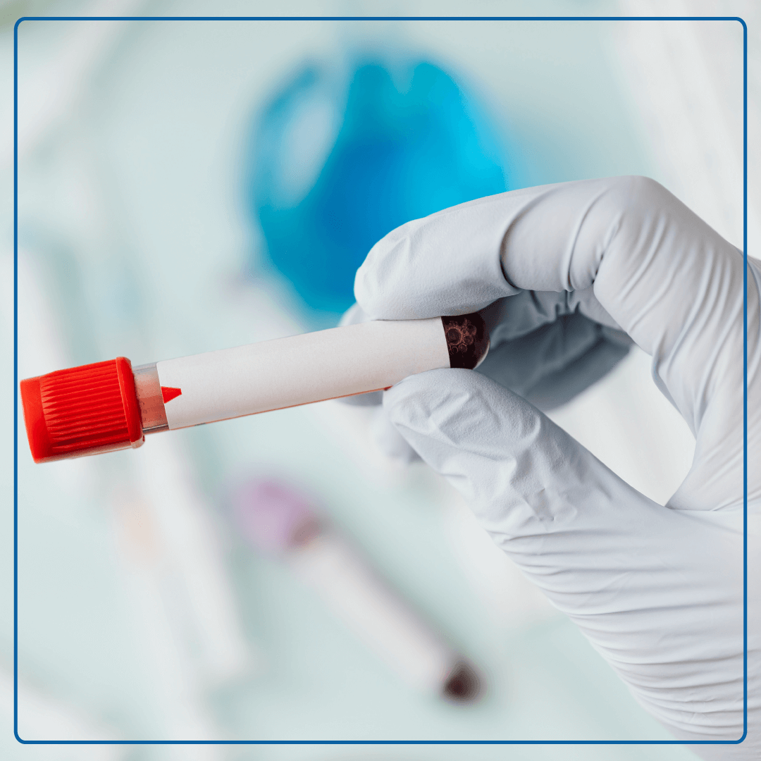 Immagine delle mani di operatore sanitario con una fiala di sangue utilizzata per esami ematochimici. Foto utilizzata per la pagina Analisi di Laboratorio.