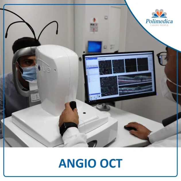 Immagine, con logo di Polimedica Melfi, di uno specialista in oftalmologia che esegue un esame Angio OCT ad un paziente. Foto utilizzata per la pagina Angio OCT.