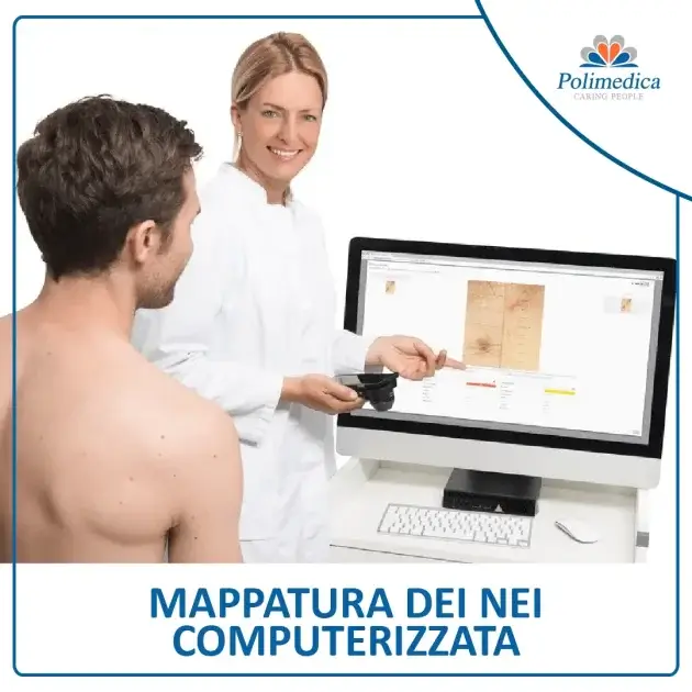 Foto, con logo di Polimedica Melfi, di un medico che fa vedere ad un paziente a torso nuda la mappatura dei nei del suo corpo sul monitor di un computer. Immagine utilizzata per la pagina Mappatura dei nei computerizzata.